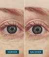 Produktbild 4 von 5, APRICOT Wiederverwendbare Augenpad Augenpads