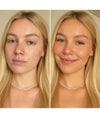 Produktbild 6 von 6, VENICEBEAUTY Instant Selbstbräunungsserum