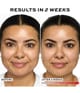 Produktbild 6 von 6, REVOLUTION PRO Miracle LED Lichttherapiegerät
