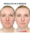 Produktbild 6 von 6, REVOLUTION PRO Miracle LED Lichttherapiegerät