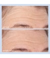 Produktbild 3 von 6, Perricone MD Cold Plasma Plus+ Tagescreme