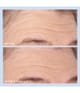 Produktbillede 3 af 6, Perricone MD Cold Plasma Plus+ Dagcreme
