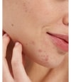 Productafbeelding 3 van 6, Pai Skincare Salicylic Acid Serum