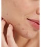Produktbild 3 von 6, Pai Skincare Salicylic Acid Gesichtsserum