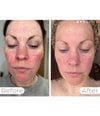 Produktbild 3 von 5, STYLPRO Wavelength Lichttherapiegerät