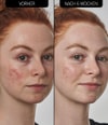 Produktbillede 4 af 5, The INKEY List SuperSolutions Serum