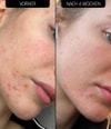 Produktbillede 4 af 5, The INKEY List Blemish Clearing Moisturizer Ansigtscreme