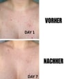 Produktbild 3 von 5, The INKEY List Glycolic Acid Exfoliating Körperpeeling