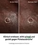 Obrázek produktu 2 z 4, The INKEY List Hydrocolloid Invisible Náplasti na pupínky
