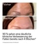 Produktbillede 6 af 6, The INKEY List Starter Serum