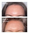 Produktbillede 6 af 6, The INKEY List Advanced Serum