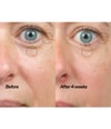 Obrázek produktu 2 z 6, The INKEY List Bio-active Ceramide Eye Cream Oční krém
