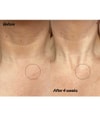 Produktbild 2 von 6, The INKEY List Bio-active Ceramide Neck Stick Dekolletécreme