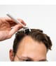 Produktbillede 4 af 4, Scandinavian Biolabs Scalp Activation Dermaroller