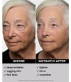 Produktbillede 2 af 6, Peter Thomas Roth Instant FIRMx® Ansigtscreme