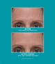 Peter Thomas Roth Peptide Skinjection™ Serum 30 ml 670367022191 visual3-shot_se