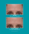 Produktbild 6 von 6, Peter Thomas Roth Peptide Skinjection™ Gesichtsserum