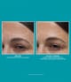 Peter Thomas Roth Peptide Skinjection™ Serum 50 ml 670367022207 visual3-shot_se