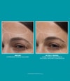 Produktbild 6 von 6, Peter Thomas Roth Peptide Skinjection™ Gesichtsserum