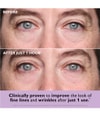 Produktbild 2 von 6, Peter Thomas Roth Instant FIRMx® Augenpads