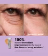 Produktbild 4 von 6, Peter Thomas Roth Instant FIRMx® Augengel