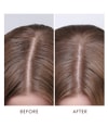 Produktbillede 4 af 6, Moroccanoil Dry-No-More Scalp Treatment Hovedbundspleje