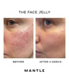 Image du produit 4 sur 6, MANTLE The Face Jelly Gel visage