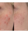 Produktbillede 4 af 5, MANTLE The Spot Solution Serum