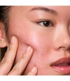Produktbild 5 von 5, MANTLE The Spot Solution Gesichtsserum