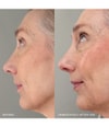 Productafbeelding 3 van 5, MANTLE The Daily SPF 50+ Zonnecrème