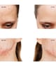 Produktbillede 5 af 6, FOREO ESPADA™ 2 Ansigtsscrub