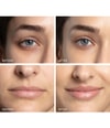 Produktbild 5 von 6, FOREO BEAR™ 2 Massagegerät