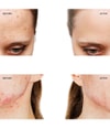 Produktbillede 5 af 6, FOREO ESPADA™ 2 Ansigtsscrub