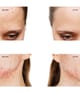 Produktbild 5 av 6, FOREO ESPADA™ 2 Ansiktsskrubb