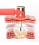 FOREO PEACH™ 2 IPL-hårborttagningslaser 1 st 7350120791887 visual-shot_se