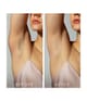 FOREO PEACH™ 2 IPL-hårborttagningslaser 1 st 7350120791887 visual2-shot_se