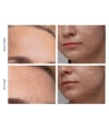 Produktbillede 4 af 5, FOREO KIWI™ Lysterapiapparat