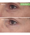 Produktbild 3 von 6, Murad Resurgence Augencreme