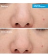 Produktbild 2 von 6, Murad Blemish Control Gesichtsserum