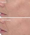 Produktbild 5 von 6, Murad Resurgence Gesichtsserum