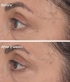 Produktbild 6 von 6, Murad Resurgence Gesichtsserum