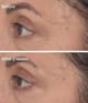 Produktbild 6 von 6, Murad Resurgence Gesichtsserum