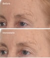 Produktbild 3 von 6, Murad Resurgence Nachtcreme