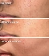 Produktbild 5 von 6, Murad Blemish Control Gesichtscreme