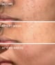 Produktbild 5 von 6, Murad Blemish Control Gesichtscreme