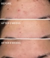 Produktbild 6 von 6, Murad Blemish Control Gesichtscreme