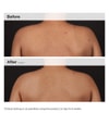 Produktbillede 5 af 6, The Ordinary Body Care Kropsserum