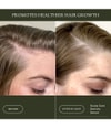 Productafbeelding 3 van 6, Living Proof Scalp Care Haarserum