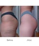 Productafbeelding 5 van 6, COCUNAT Body Power Persoonlijke verzorgingsset