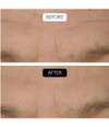 Produktbild 4 von 6, COCUNAT Clinical Gesichtsserum